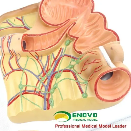 Ileocecal анатомическая модель человеческого тела; Приложение caecum, восходящий узловой лимфатической моделью; Медицинская модель