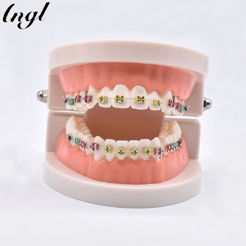 Dental Orthodontic Treatment Model With Ortho Metal Ceramic Bracket Arch Wire Buccal Tube Ligature Ties Dental Tools Dentist Lab