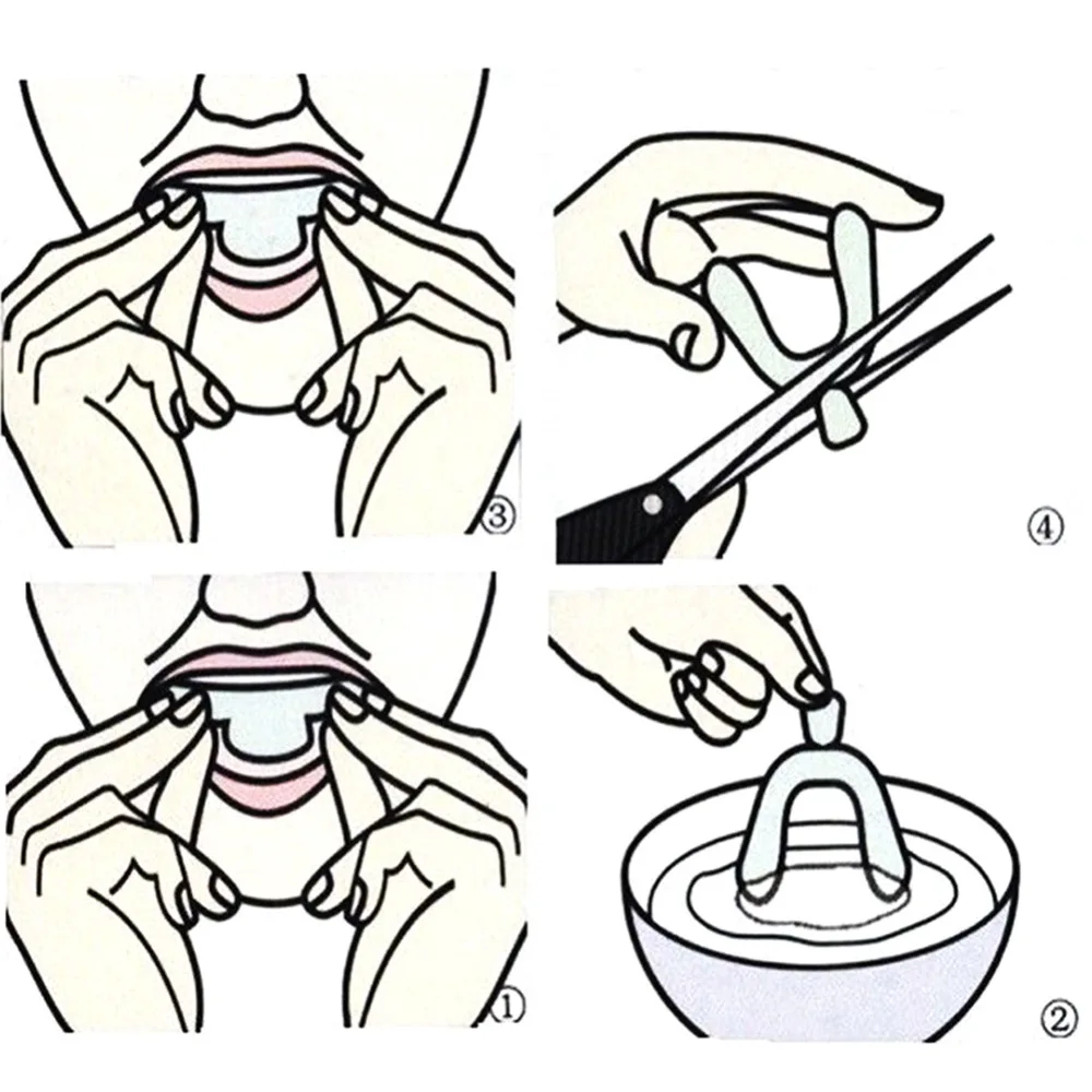 4 Silicone Đêm Bảo Vệ Miệng Cho Răng Clenching Mài Răng Cắn Hỗ Trợ Giấc Ngủ Làm Trắng Răng Miệng Khay