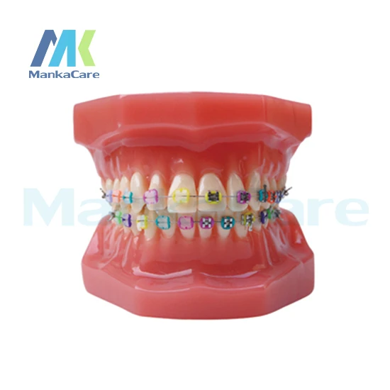 

Manka Care - 28 pcs Tooth, half metal&half ceramic bracket Oral Model Teeth Tooth Model