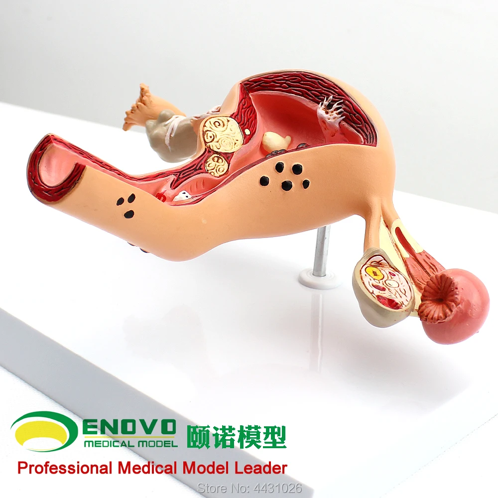 ENOVO Model of gynecological and obstetrical disease model of gynecology and obstetrics gynecology