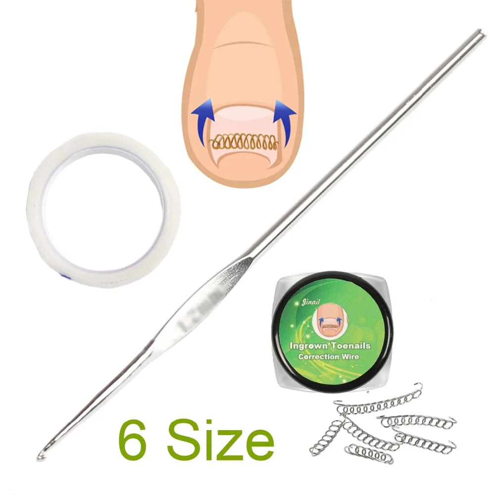 Comment utiliser le panari orteil photo pour soigner les ongles incarnés et les problèmes de pieds