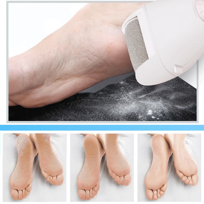 JINDING Electric Foot Polisher Exfoliation Heel Cuticles Callus Remover Foot Care with 2 Roller Heads Dead Dry Skin Removal