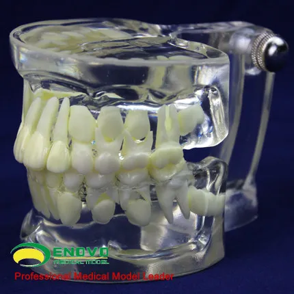 Transparent teeth teeth alternating model of child development guidance brush model