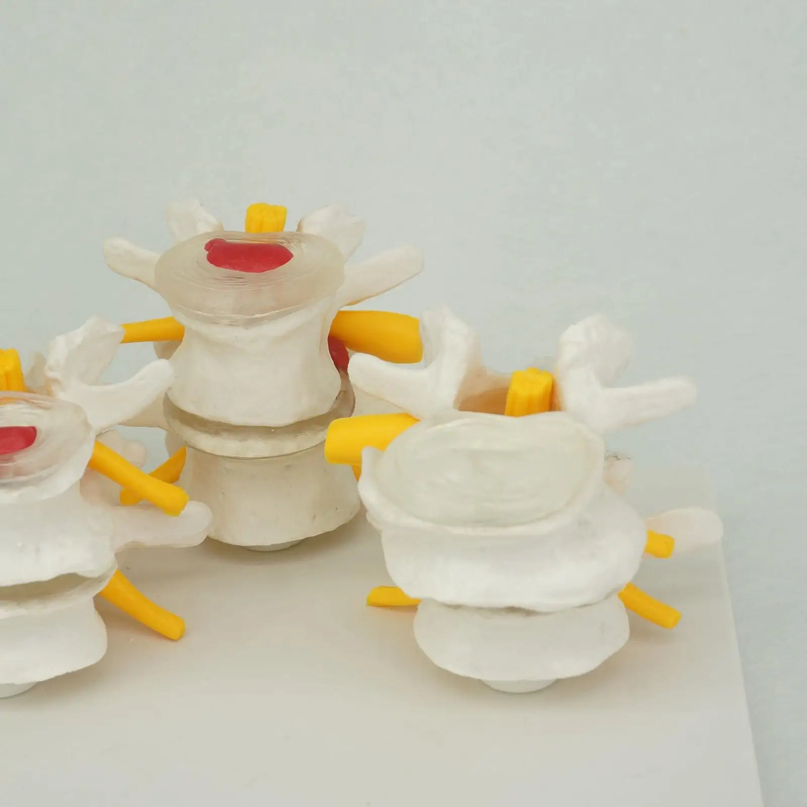 Vértebras Lombares Humanas Anatômicas Do PVC, Doença Degenerativa Do Disco, Modelo Médico