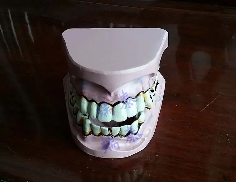 1:1,38*19*40Cm Roken Tanden Onderwijs Model Orale Apparaat