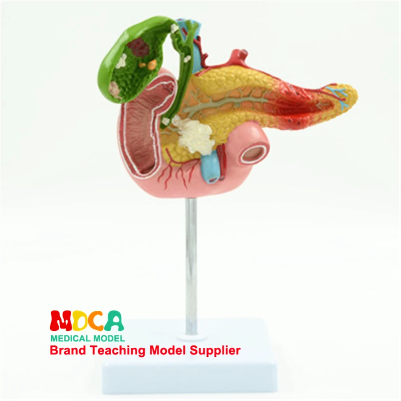 

Diseased Pancreas Spleen Hepatobiliary Duodenum Model Human Pathological Anatomy Teaching Model