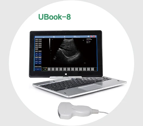 UProbe-20 Probe Type Ultrasound Scanner work with computer(windows) or tablet/phone(Androi), connect by USB Cable