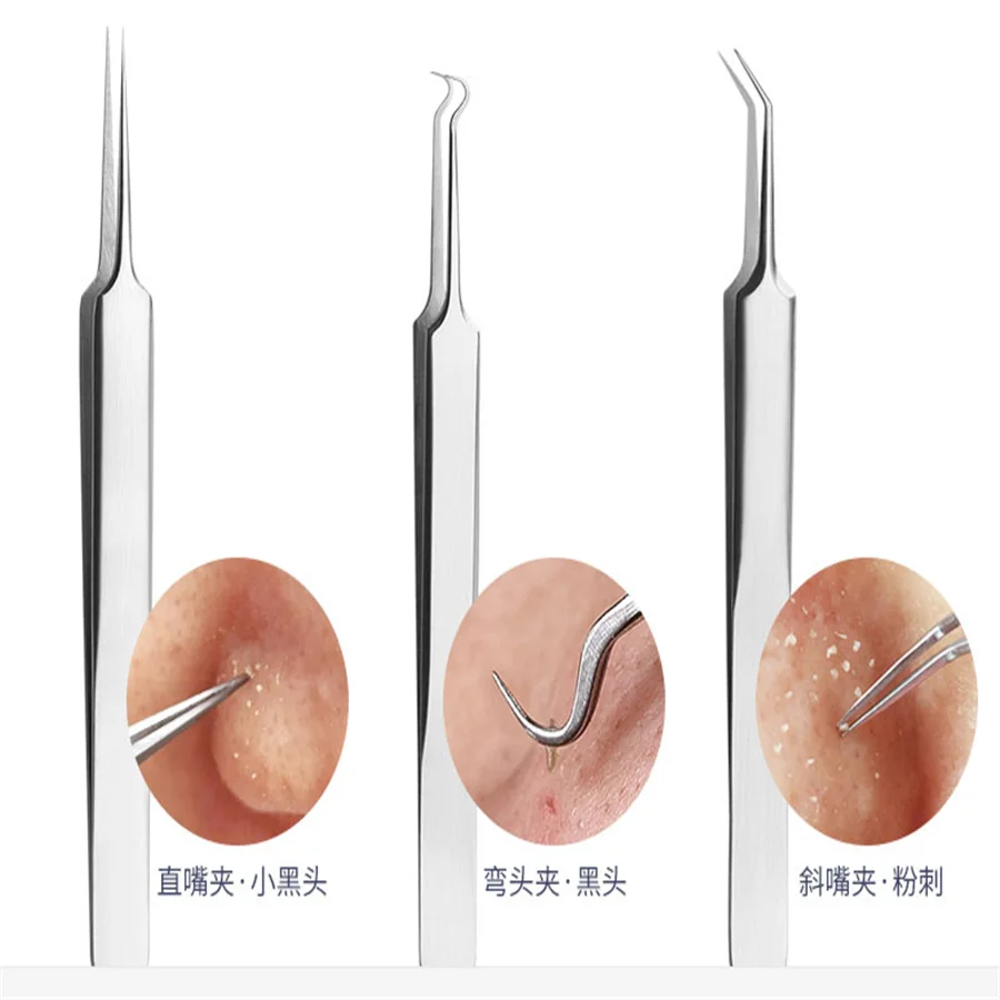 5 قطعة الفولاذ المقاوم للصدأ حب الشباب مجموعة إبرة خلية المشبك البثرة إبرة أدوات حب الشباب إبرة الملقط الجمال بثرة البثق قطعة أثرية