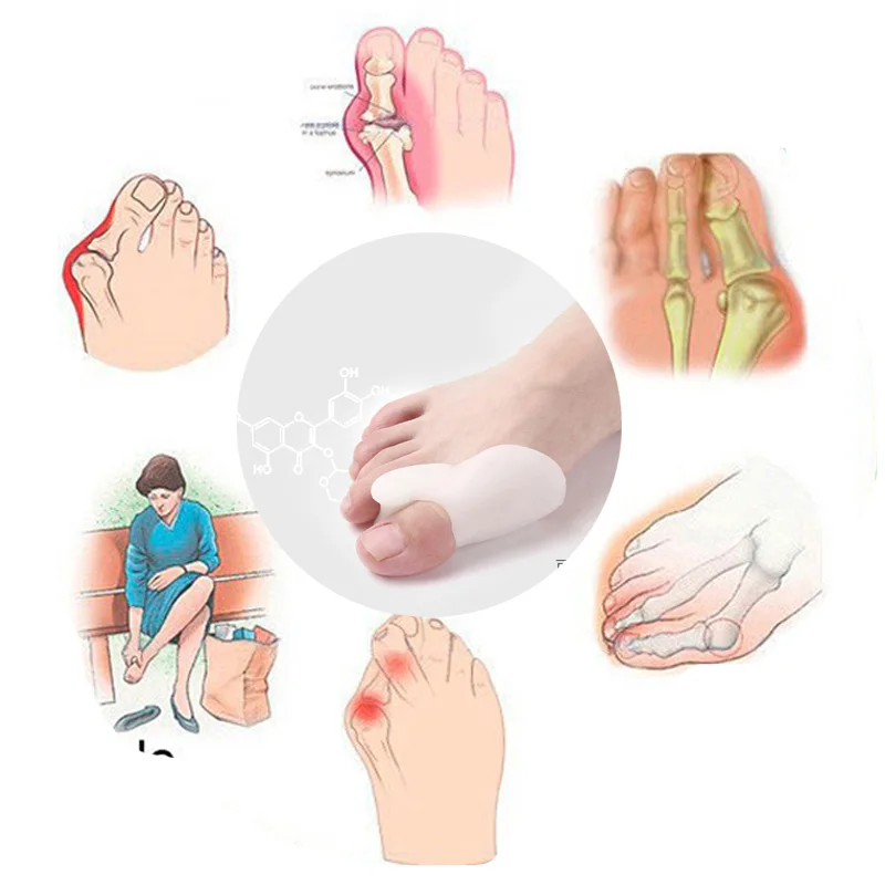 Corrector Hallux Valgus, triturador de escarabajos, electrodoméstico exterior, tecnología profesional, productos para el cuidado de la salud