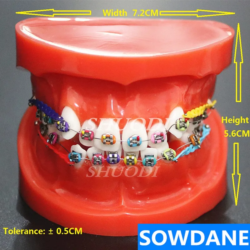 

Dental Orthodontic Mallocclusion Model Decoration with Brackets Archwire buccal tube Tooth Extraction for Patient Communication