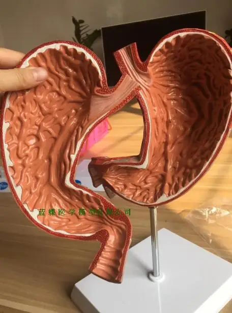 

Human gastric anatomic model digestive system model gastric model with a digital removable 1.5-fold magnification of the stomach