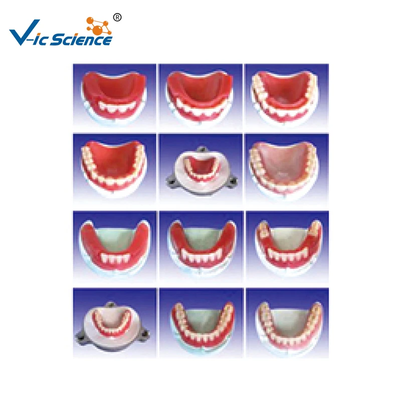 

The producing steps of metal full mouth teeth model