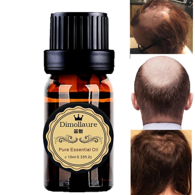 Dimollaure Hair Growth anti Hair Loss Liquid 10ml dense hair fast sunburst hair growth grow alopecia Treatment oil essence