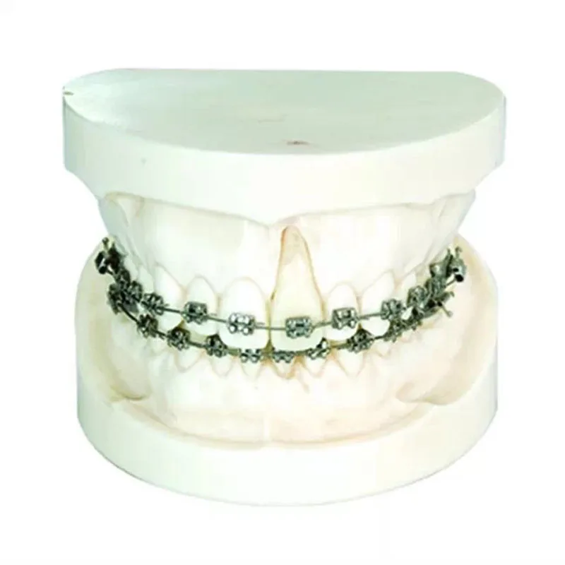 

Dental Orthodontic Model for Demonstration with Edgewise Bracket