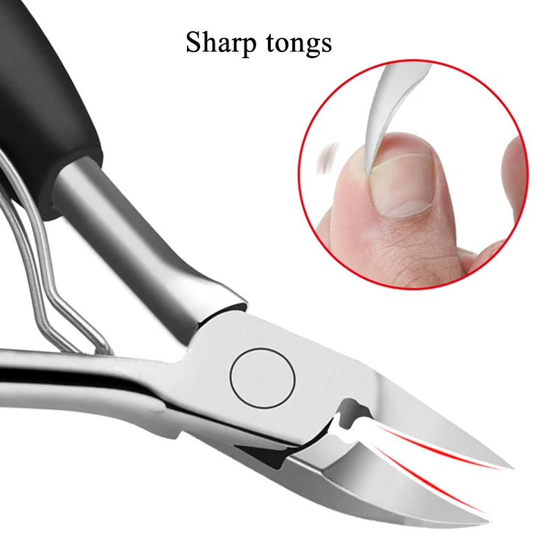 Ingrown Toenails Manicure Pedicure Foot Nail Care Tools Ingrown Toenail Fixer Recover Correction Device Onyxis Bunion Corrector