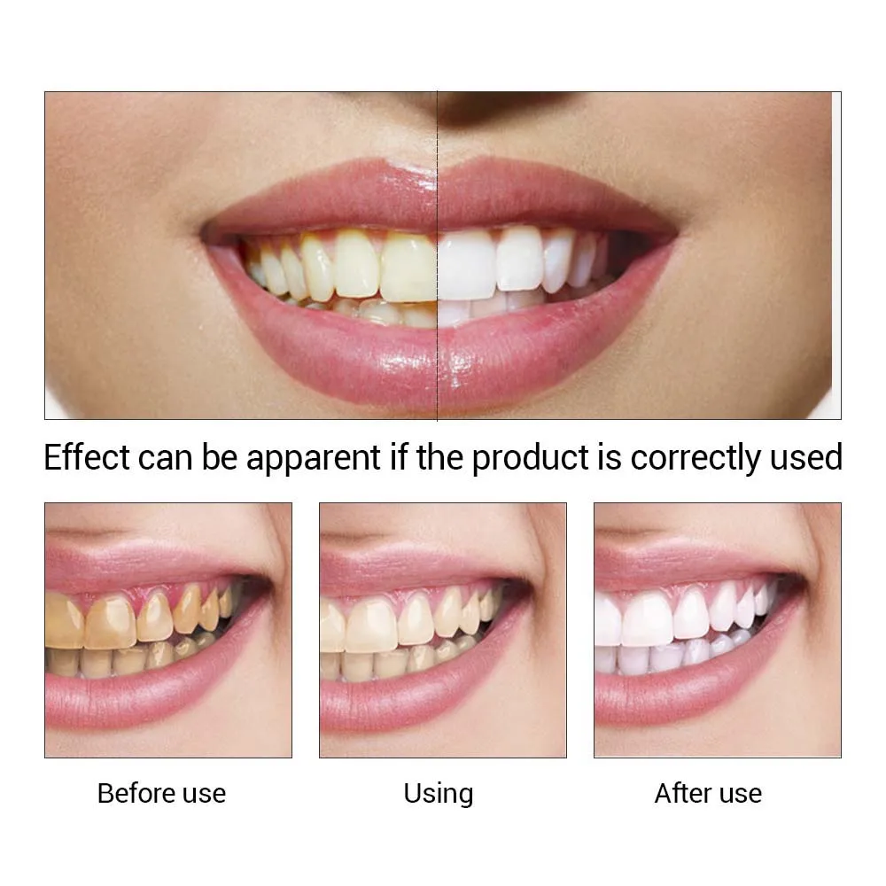 LANBENA Cleaning Serum Removes Plaque Stains Tooth Bleaching Dental Tools Essence Powder Oral Hygiene Teeth Whitening