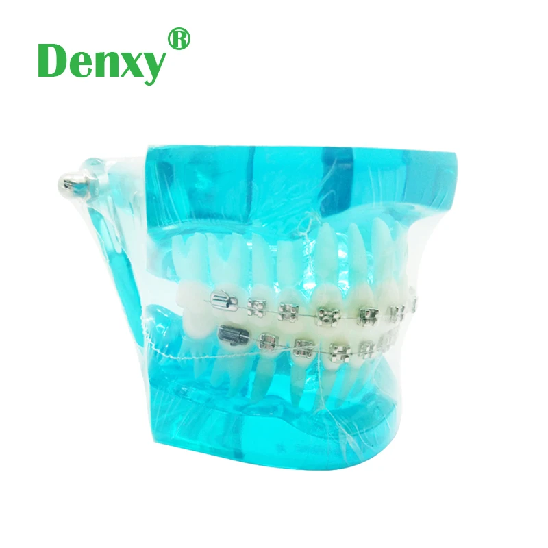 Denxy 1pc Orthodontic model for Patient learn Tooth Brushing Instruction Model with Dental Brace Dentist Teach Dental tool