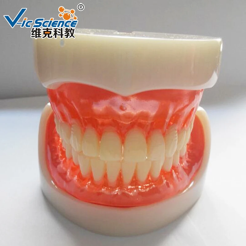 Modello di Impianto di Protesi Totale/Modello di Impianto/Protesi Dentale Denti Modello