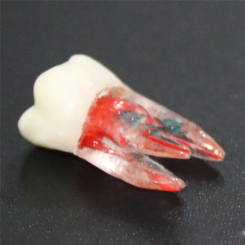 1Pc Dental Tooth model Root Canal RCT Practice Pulp Cavity Clear  Resin Teaching teeth model 1:1 Dental Model Dentist Tools