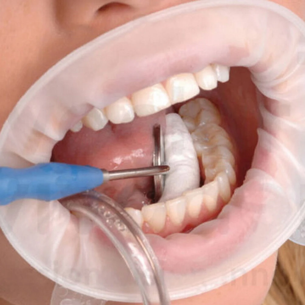 5 stücke Dental Oral Care Werkzeuge Einweg Gummi Mund Opener Dental Dam Mund Gag Cheek Retractor Dental Materialien