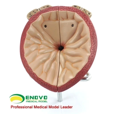 

Prostate anatomical model prostate can be divided into leaf BPH prostate examination model free shopping