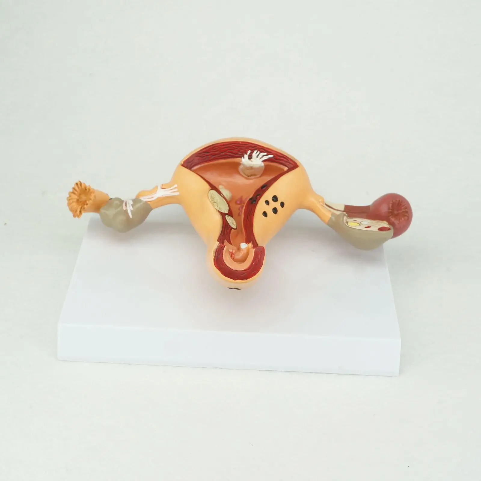 PVC Pathological Uterus and Ovary Anatomical Model Human Female Medical Anatomy Learning Kit