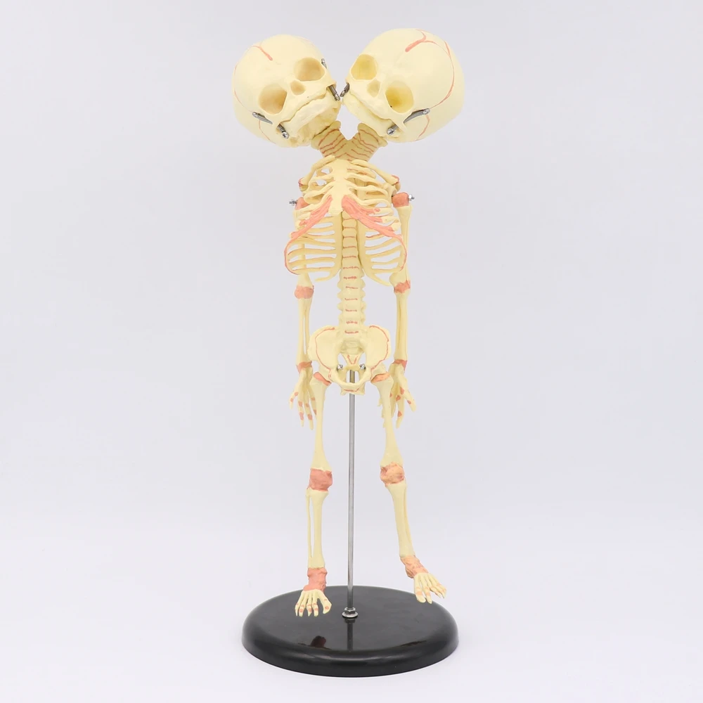 

35CM Two-headed Skull Human Newborn Baby Double Head Anatomy Skull Skeleton Anatomical Brain Education Anatomical Study Model