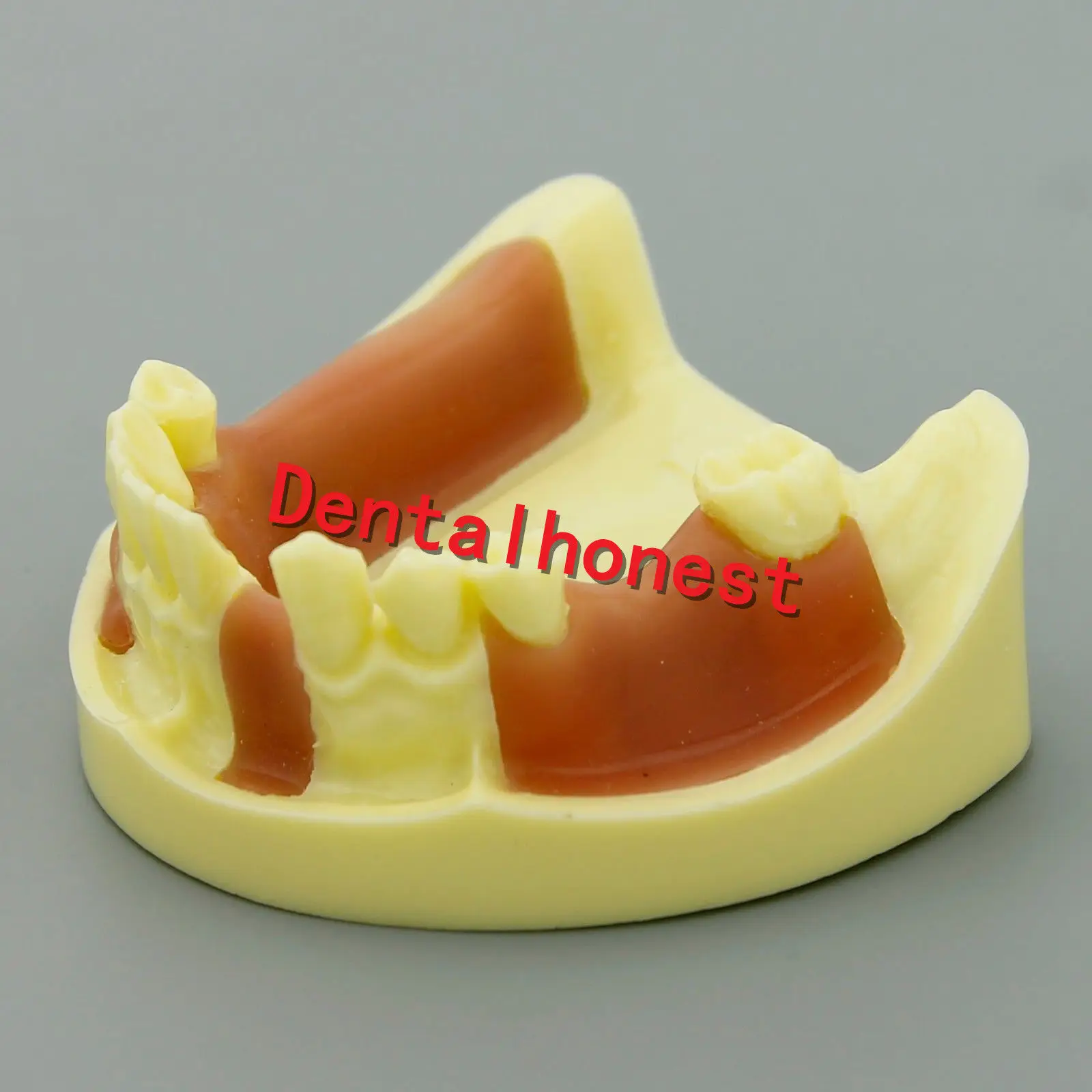 NEW Dental Lower Jaw Implant Practice Typodont Teeth Model with Gingiva