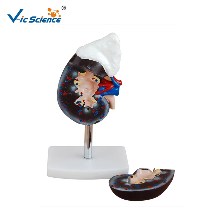 Medical Supplies Plastic Teaching Human Anatomical Kidney Model with Adrenal Gland for Students