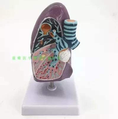 

Патологическая модель легких для дыхательной системы