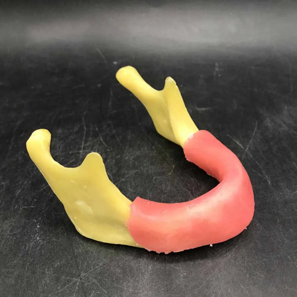 FiXangRo Dental Mandible Implant Model Training Tool With Soft Tissue for Implant Study