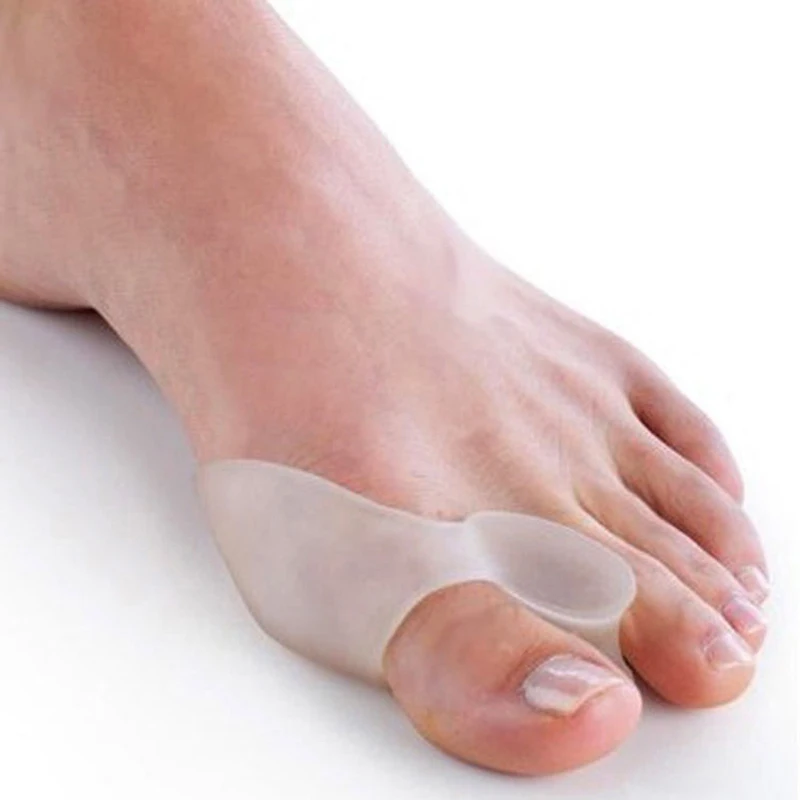 Hallux Valgus Corrector Hotsale Beetle-crusher Bone Ectropion Toes Outer Appliance Professional Technology Health Care Products