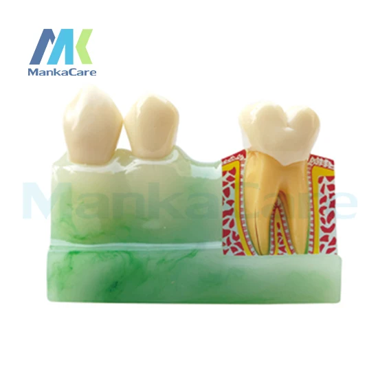 

Manka Care - 4Times Disassembling/Imported resin teeth/Imported quartz rubber plate Oral Model Teeth Tooth Model