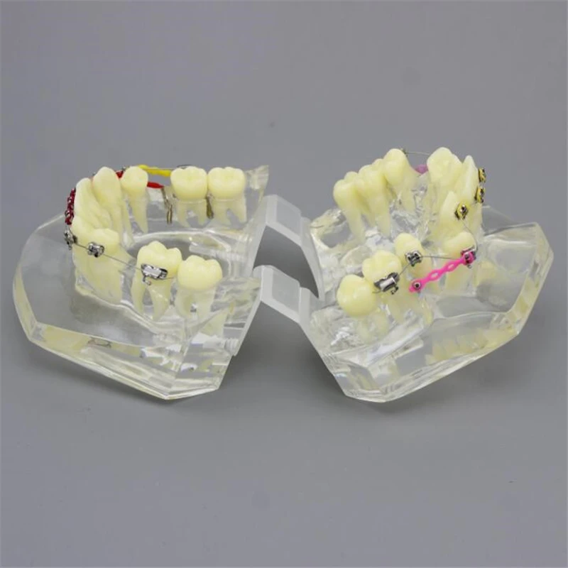 1 PCS Transparent Tooth Model Teeth Malocclusion Orthodontic Colorful Model Dental Study Dentist  Teaching