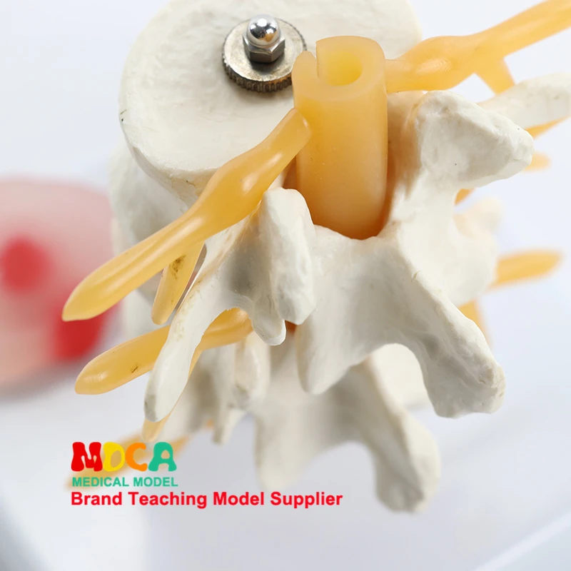 Lesioni lombari Dis intervertebrale umano.