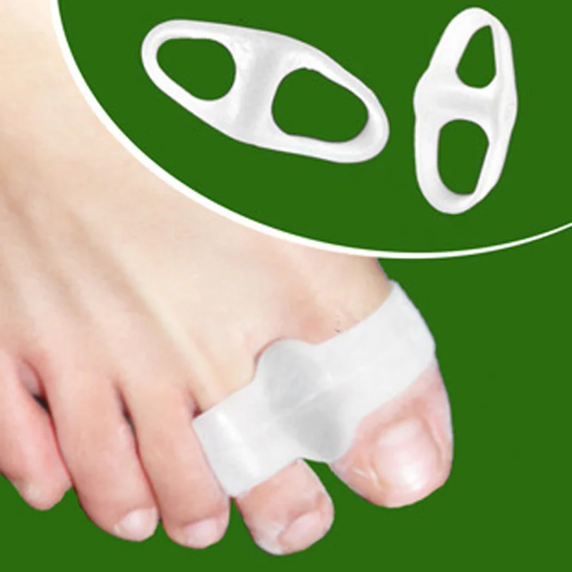 Bicyclic hallux valgus toe separator beetle crusher bone orthosis hallux valgus orthosis thumb valgus correction