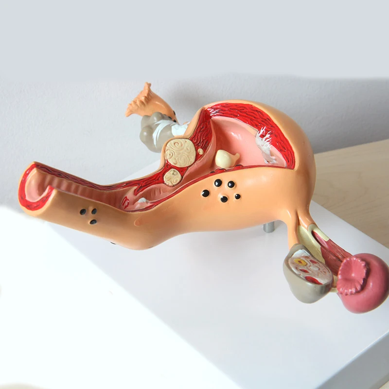 Medical Science Normal/Pathological Uterus Ovary Anatomical Model Anatomy Cross Section Medical teaching supplies