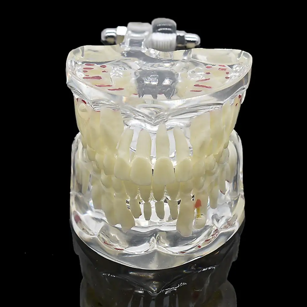 

Dentist Children Baby Pathology Medical Dental Teeth Model Pathological Model Dentistry Material Dentist Tools Dental Lab Model