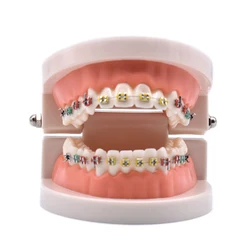 Dental Orthodontic Treatment Model With Ortho Metal Ceramic Bracket Arch Wire Buccal Tube Ligature Ties Dental Tools Dentist Lab