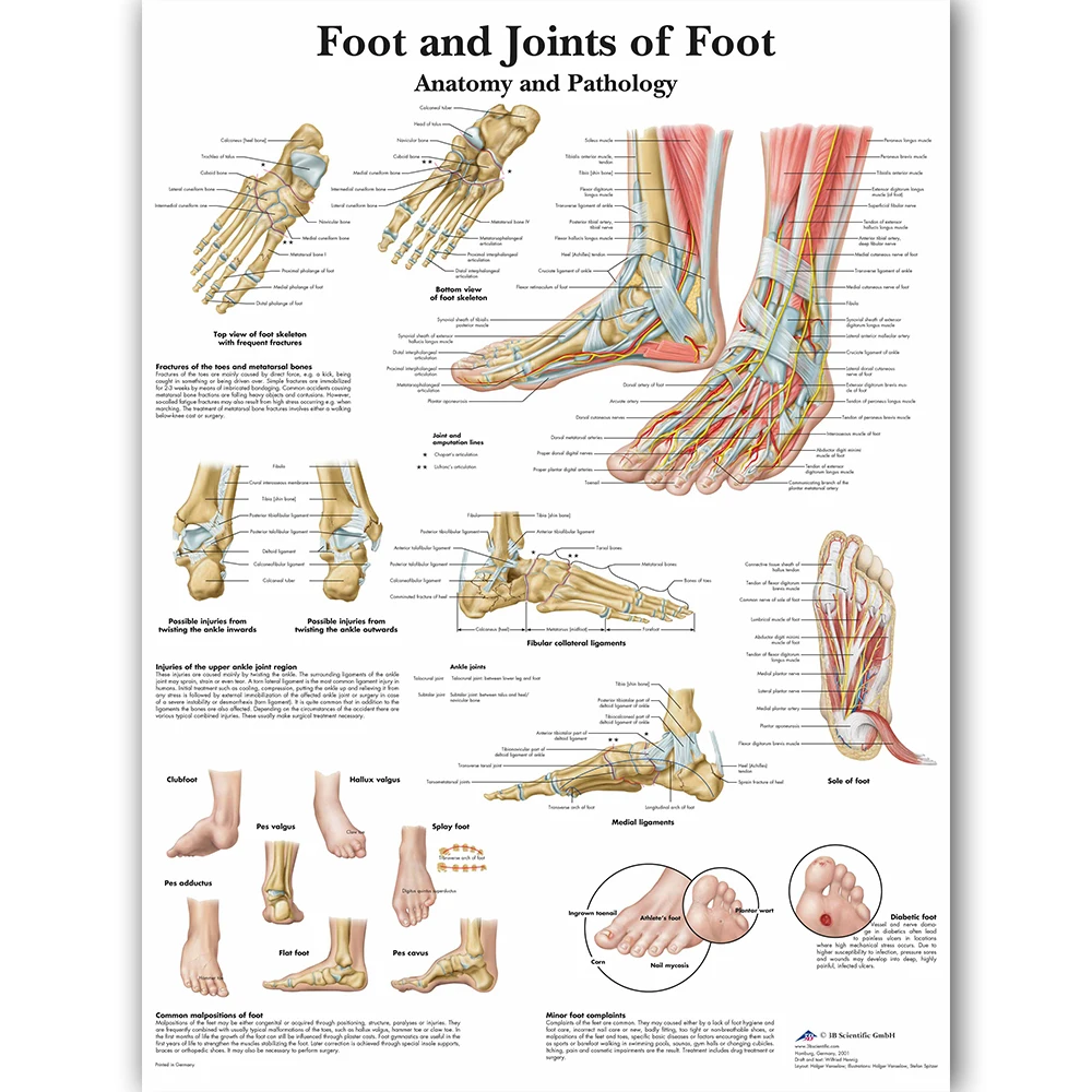 Foot Joints of Foot Chart Anatomy Pathology Poster Canvas Painting Wall Pictures for Medical Education Doctors Office Classroom