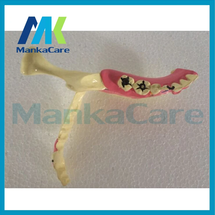 Manka Care - Advanced Simulation Model of Mandibular Tissue Decomposition,Simulation Model of Mandibular Structures