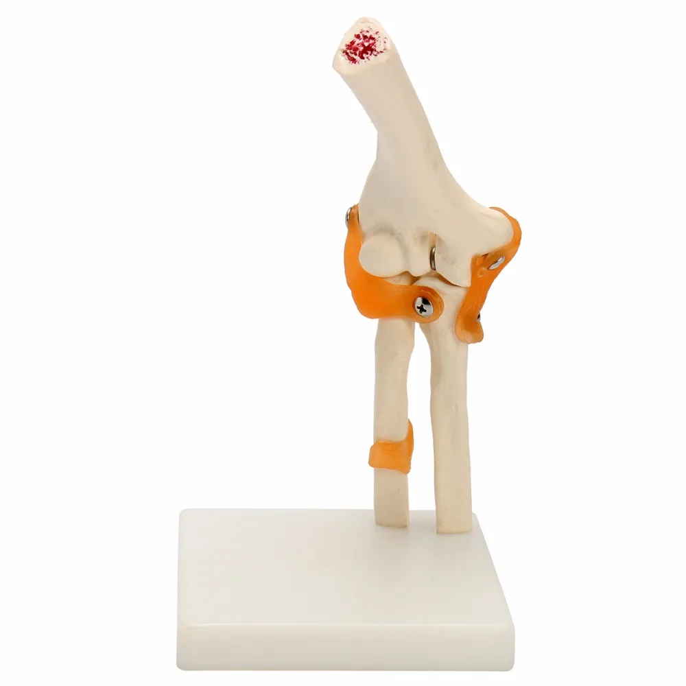 Human Elbow Joint Model Anatomical Anatomy Elbow Joint Medical Model Orthopedics