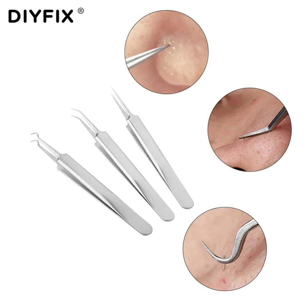 DIYFIX-ملاقط إبرة حب الشباب ، إزالة البثور والرؤوس السوداء ، أدوات العناية بالوجه ، الرؤوس السوداء