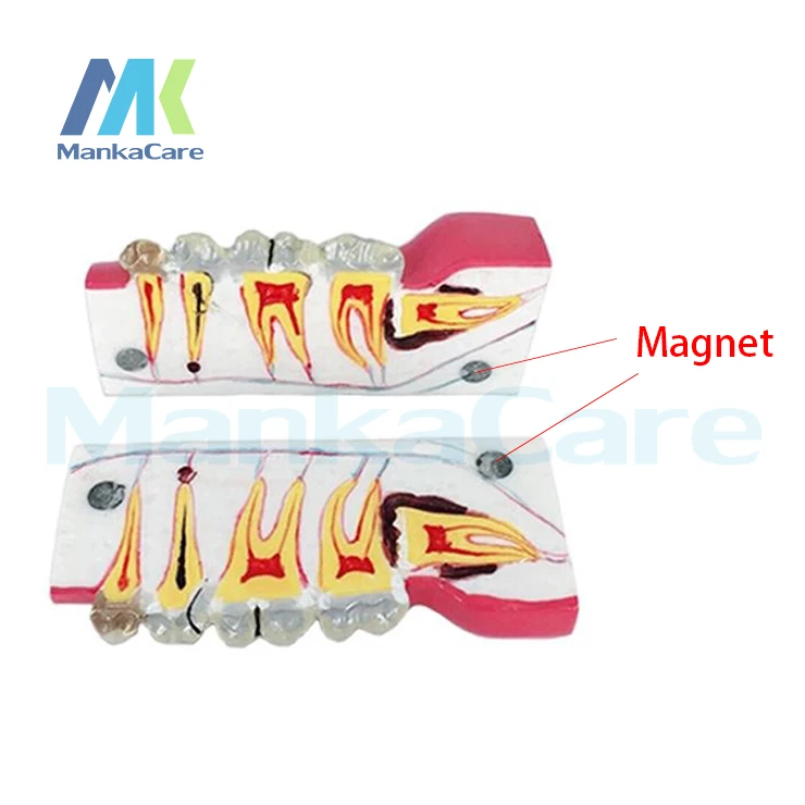 2 times Sagitally Section Model/Tissue decomposition model for Doctor - patient communication model with magnetic