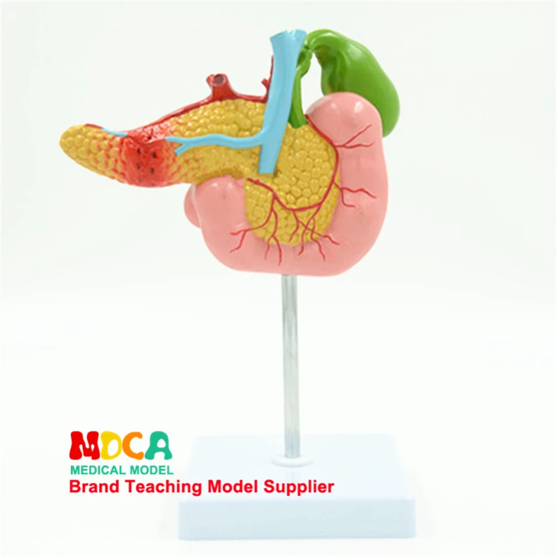 Diseased Pancreas Spleen Hepatobiliary Duodenum Model Human Pathological Anatomy Teaching Model