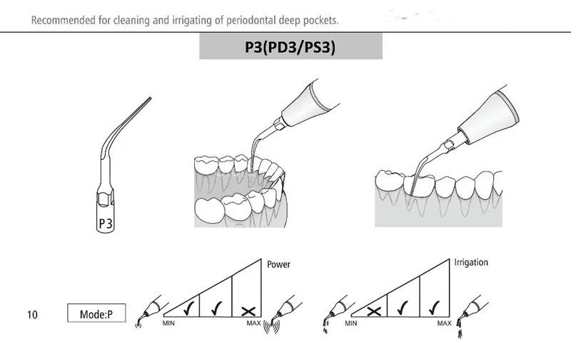 10pcs PD3 dental scaler tips dental equipment teeth whitening ultrasonic dental scaler tip PD3 for SATELEC NSK GNATUS DTE