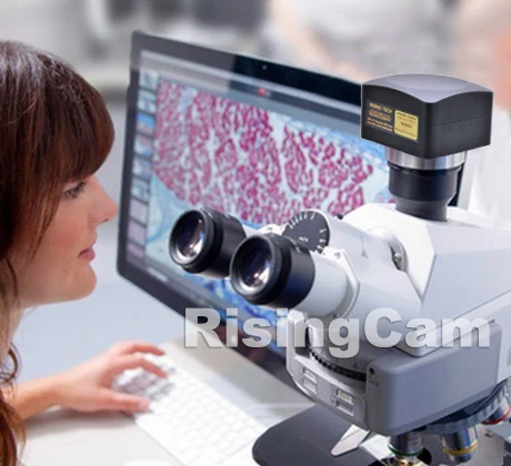 high frame rate 25MP SONY imx511 CMOS sensor USB3.0 digital video biological microscope Camera with C mount