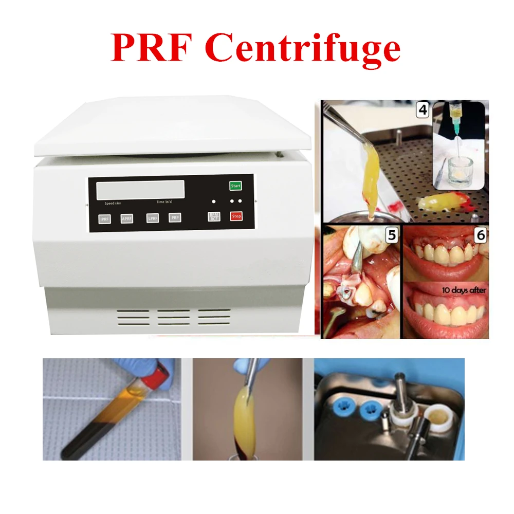 PRF Centrifuge fits for PRF tube 10ml and 12 tube Al angle rotorn for dental, plastic surgen use