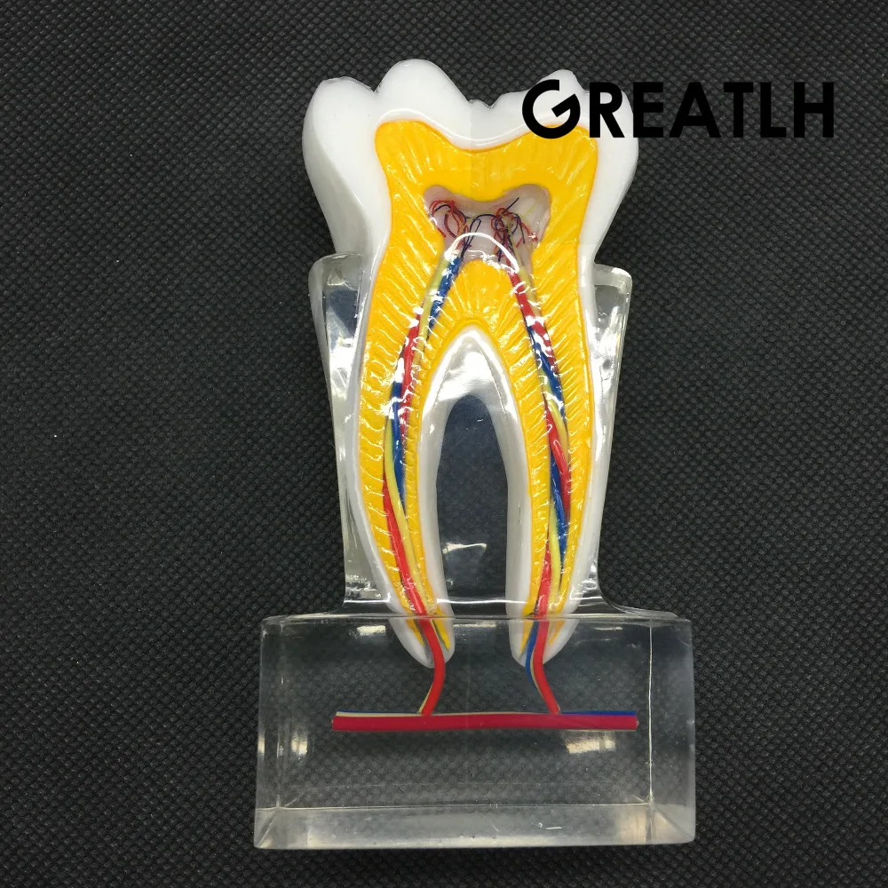 Dental Anatomical Molar Model 2017 molar inner structure with nerves and vessels